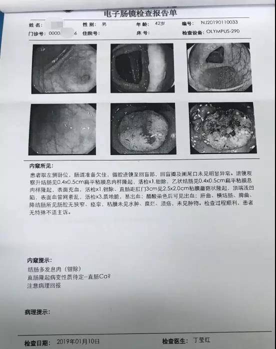 直肠癌四期患者生存奇迹,19年的坚韧与希望之路,直肠癌四期患者的生命奇迹,19年坚韧之路,希望永不止步