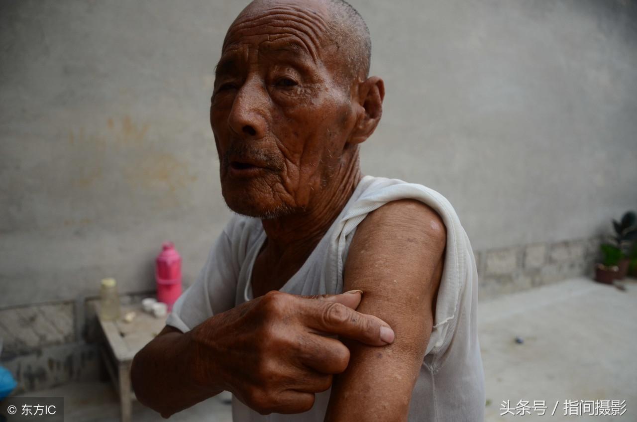 当兵疤痕要求及解读，当兵疤痕要求解读，标准与评估方法