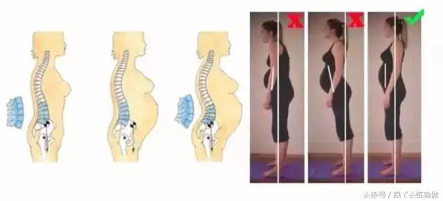 产后修复与产后瑜伽,哪个更适合你?,产后修复与产后瑜伽,哪个更适合产后恢复?