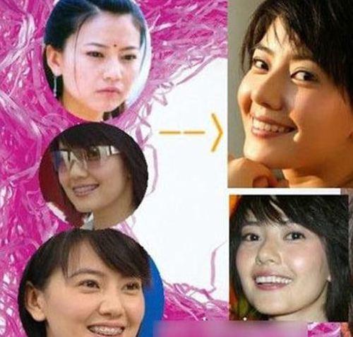 女演员整容前后的故事与反思,女演员整容前后的故事,蜕变背后的反思与探讨