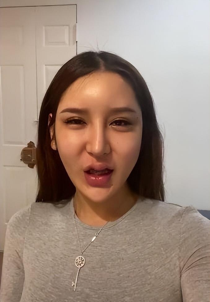 整容失败的脸,探索背后的故事与教训,整容失败背后的故事与教训探索