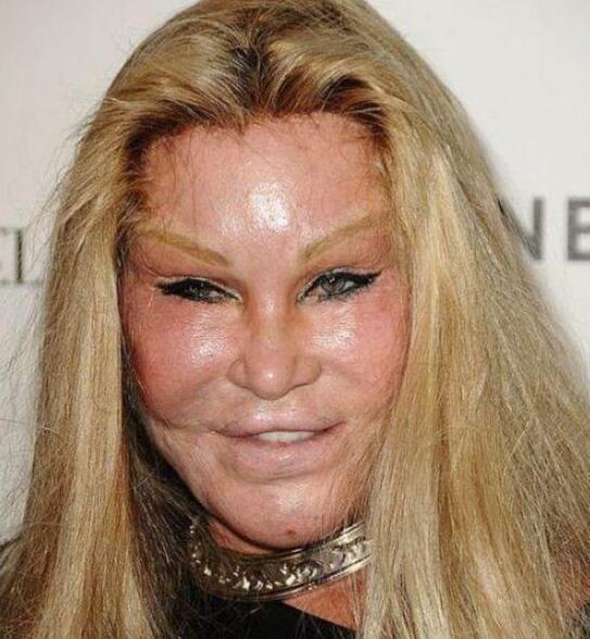 整容失败的脸,探索背后的故事与教训,整容失败背后的故事与教训探索