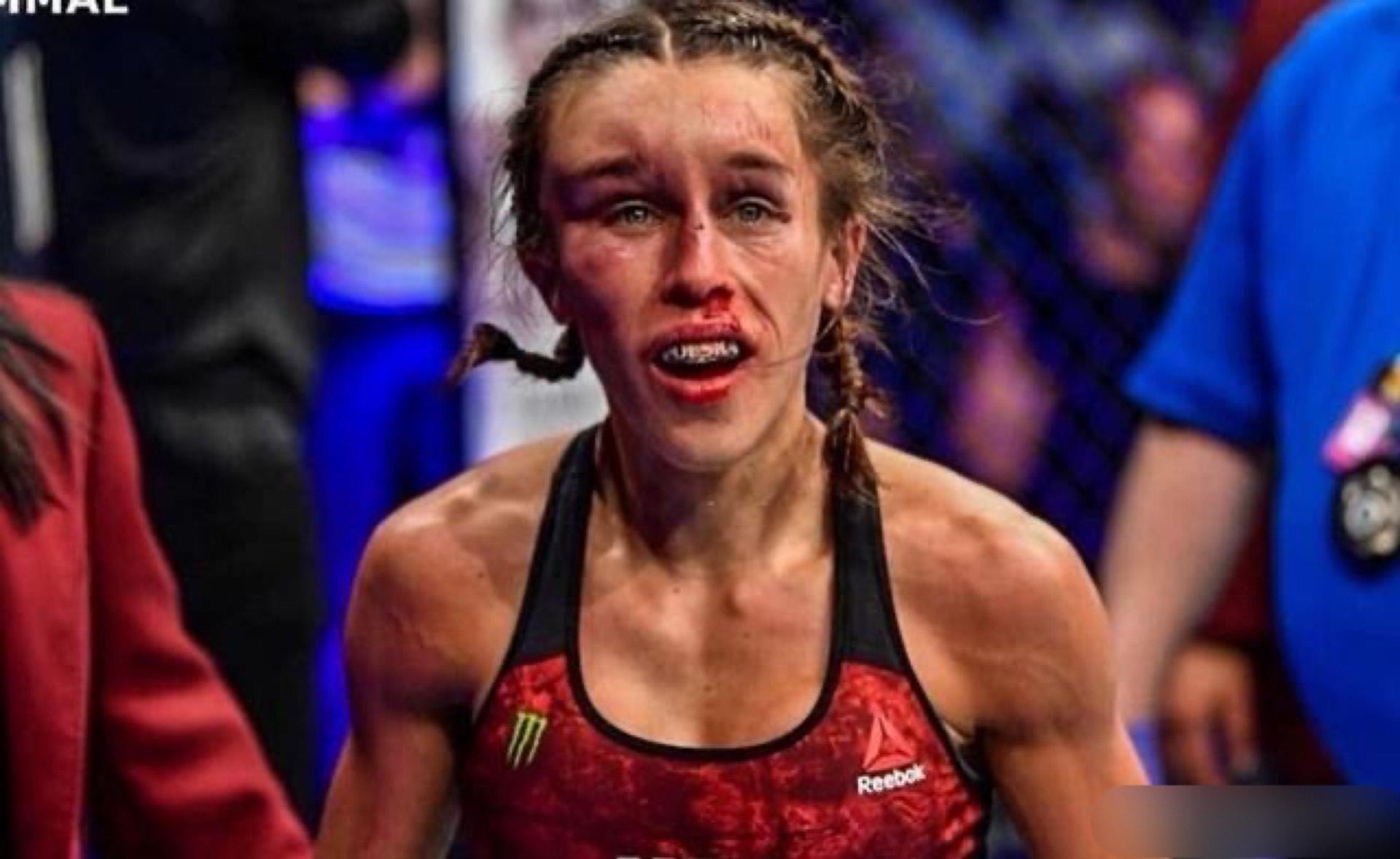 张伟丽最新比赛,展现无与伦比的实力与毅力,张伟丽展现惊人实力与毅力,最新比赛震撼全场!